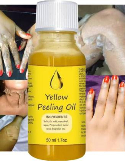 Yellow Peel Oil Free Post Peel Neutralizer | Naturally Removes Dead Skin Layer ( Pack Of 2)